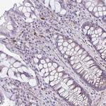 DEPP Antibody in Immunohistochemistry (Paraffin) (IHC (P))