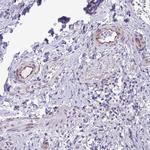 DEPP Antibody in Immunohistochemistry (Paraffin) (IHC (P))