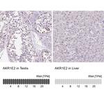 AKR1E2 Polyclonal Antibody