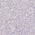 AKR1E2 Antibody in Immunohistochemistry (IHC)