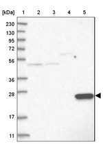 AKR1E2 Antibody in Western Blot (WB)