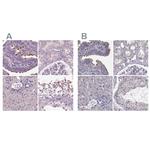 ARMC3 Polyclonal Antibody