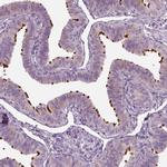ARMC3 Antibody in Immunohistochemistry (IHC)