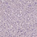 ARMC3 Antibody in Immunohistochemistry (IHC)