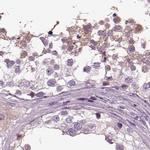 ARMC3 Antibody in Immunohistochemistry (IHC)