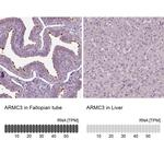 ARMC3 Antibody