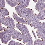 ARMC3 Antibody in Immunohistochemistry (IHC)