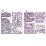 ARMC3 Antibody in Immunohistochemistry (IHC)