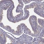 ARMC3 Antibody in Immunohistochemistry (IHC)
