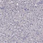 ARMC3 Antibody in Immunohistochemistry (IHC)