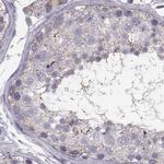ARMC3 Antibody in Immunohistochemistry (IHC)