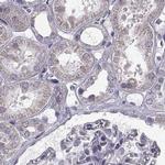 ARMC3 Antibody in Immunohistochemistry (IHC)