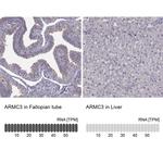 ARMC3 Antibody