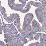 ARMC3 Antibody in Immunohistochemistry (IHC)