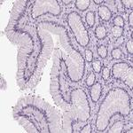 ARMC4 Antibody in Immunohistochemistry (Paraffin) (IHC (P))