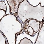 AFAP1L2 Antibody in Immunohistochemistry (Paraffin) (IHC (P))