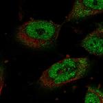 STOX1 Polyclonal Antibody