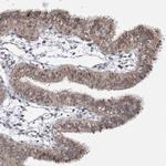 STOX1 Antibody in Immunohistochemistry (IHC)