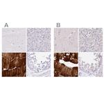 MYOZ1 Polyclonal Antibody