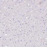 MYOZ1 Antibody in Immunohistochemistry (IHC)