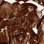 MYOZ1 Antibody in Immunohistochemistry (IHC)