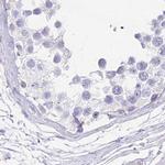 MYOZ1 Antibody in Immunohistochemistry (IHC)