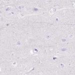 MYOZ1 Antibody in Immunohistochemistry (IHC)