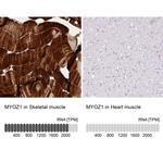 MYOZ1 Antibody