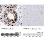 HORMAD1 Polyclonal Antibody