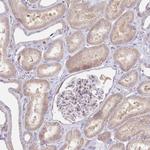 POGLUT1 Antibody in Immunohistochemistry (Paraffin) (IHC (P))