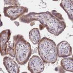POGLUT1 Antibody in Immunohistochemistry (Paraffin) (IHC (P))