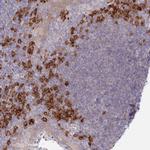 POGLUT1 Polyclonal Antibody