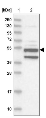 XYLB Antibody in Western Blot (WB)