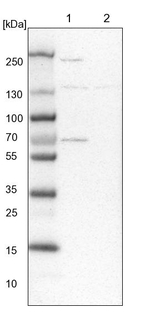 XYLB Antibody in Western Blot (WB)