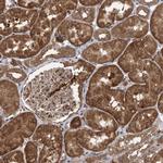 C12orf4 Antibody in Immunohistochemistry (Paraffin) (IHC (P))