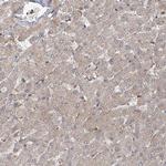 C12orf4 Antibody in Immunohistochemistry (Paraffin) (IHC (P))