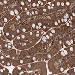 C12orf4 Antibody in Immunohistochemistry (Paraffin) (IHC (P))
