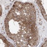 C12orf4 Antibody in Immunohistochemistry (Paraffin) (IHC (P))