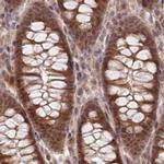 WAPL Antibody in Immunohistochemistry (IHC)