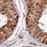 WAPL Antibody in Immunohistochemistry (IHC)