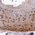 WAPL Antibody in Immunohistochemistry (IHC)