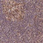 WAPL Antibody in Immunohistochemistry (IHC)