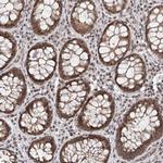 FAM13C Antibody in Immunohistochemistry (Paraffin) (IHC (P))