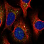 PPIP5K2 Polyclonal Antibody