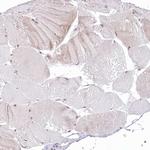 NSUN2 Polyclonal Antibody