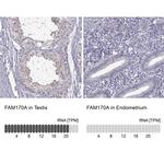 FAM170A Polyclonal Antibody