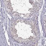 FAM170A Antibody in Immunohistochemistry (IHC)