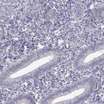 FAM170A Antibody in Immunohistochemistry (IHC)