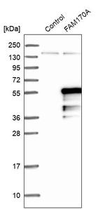FAM170A Antibody in Western Blot (WB)
