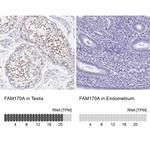 FAM170A Polyclonal Antibody
